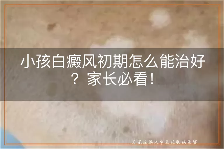小孩白癜风初期怎么能治好？家长必看！