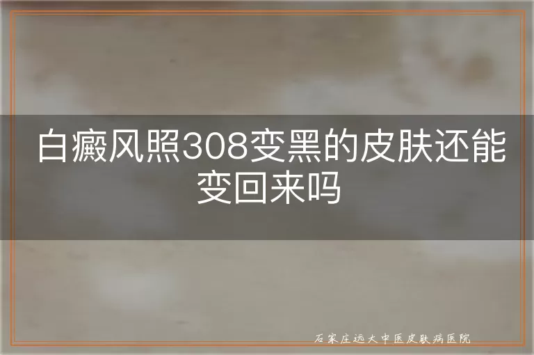 白癜风照308变黑的皮肤还能变回来吗