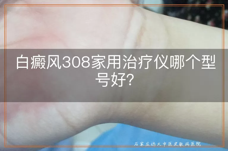 白癜风308家用治疗仪哪个型号好？