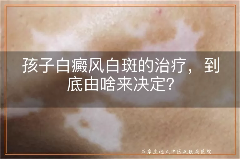 孩子白癜风白斑的治疗，到底由啥来决定？