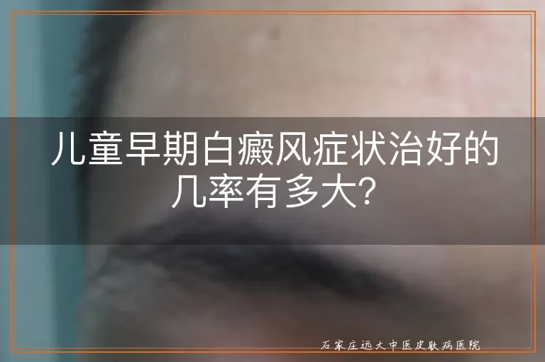 儿童早期白癜风症状治好的几率有多大？