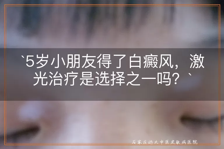 5岁小朋友得了白癜风,激光治疗是选择之一吗?