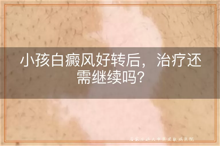 小孩白癜风好转后，治疗还需继续吗？
