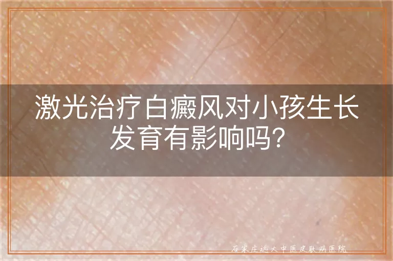 激光治疗白癜风对小孩生长发育有影响吗？