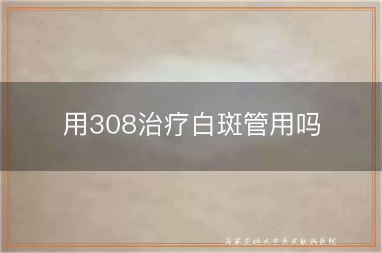用308治疗白斑管用吗
