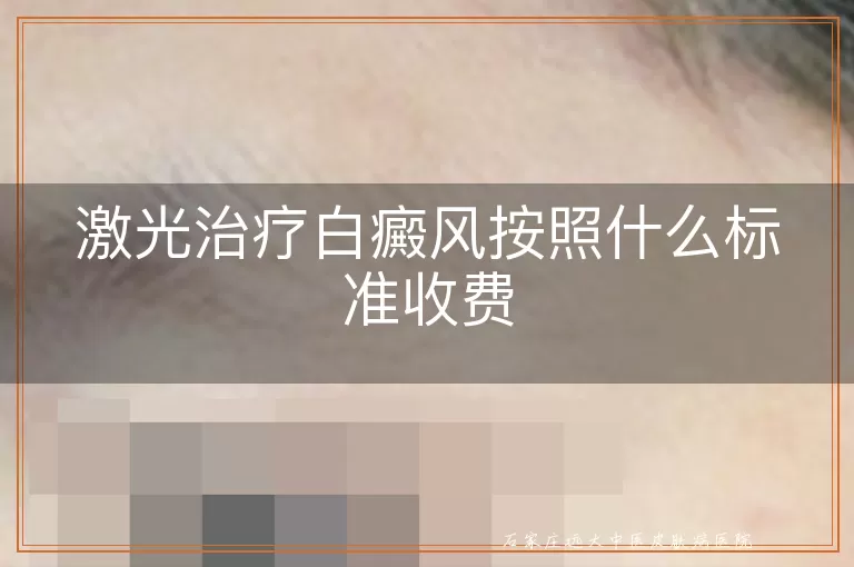 激光治疗白癜风按照什么标准收费