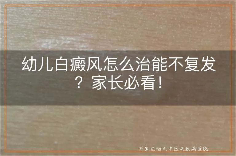 幼儿白癜风怎么治能不复发？家长必看！