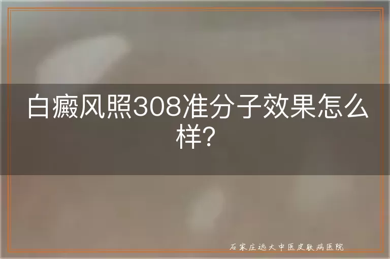 白癜风照308准分子效果怎么样？