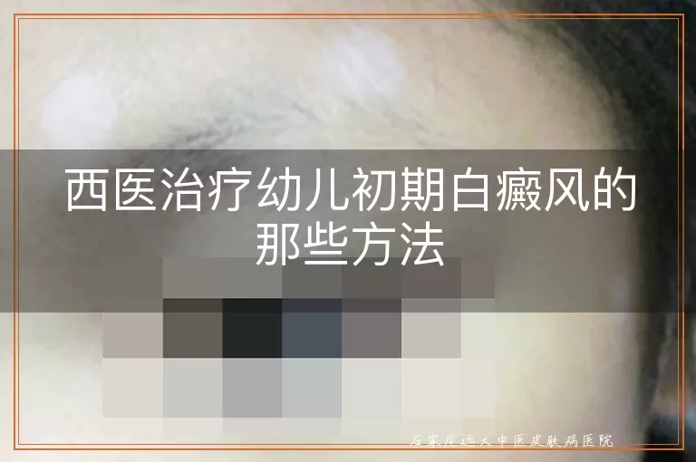 西医治疗幼儿初期白癜风的那些方法