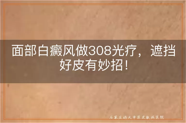 面部白癜风做308光疗，遮挡好皮有妙招！