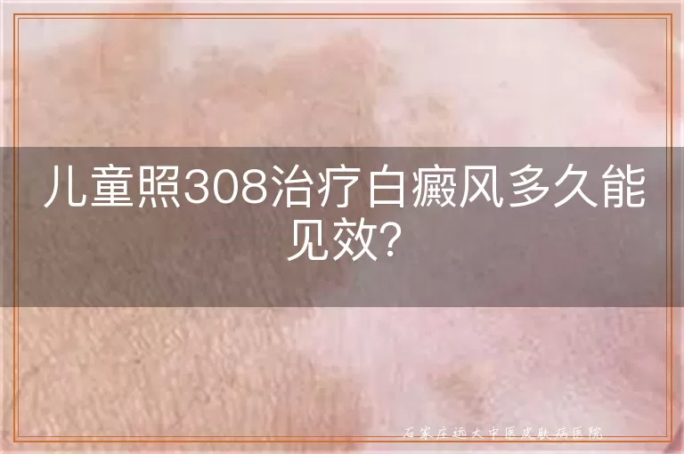 儿童照308治疗白癜风多久能见效？