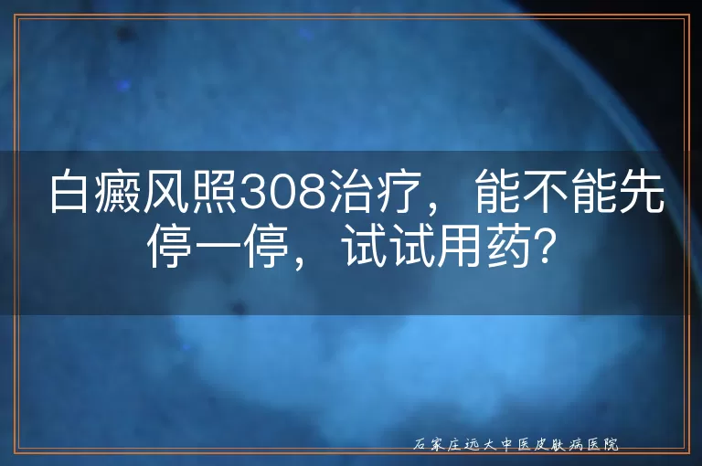 白癜风照308治疗，能不能先停一停，试试用药？