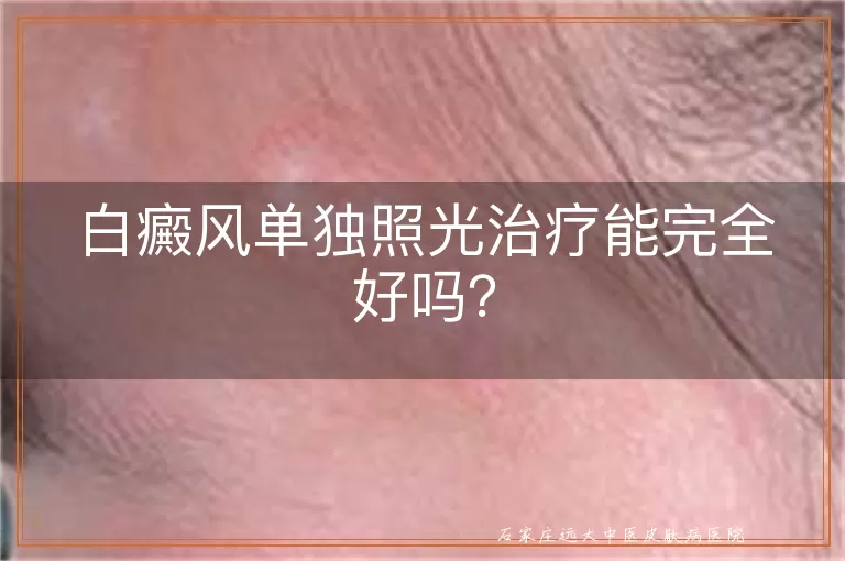 白癜风单独照光治疗能完全好吗？