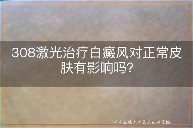 308激光治疗白癜风对正常皮肤有影响吗？