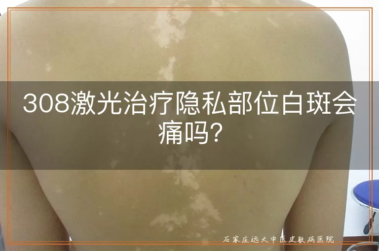 308激光治疗隐私部位白斑会痛吗？