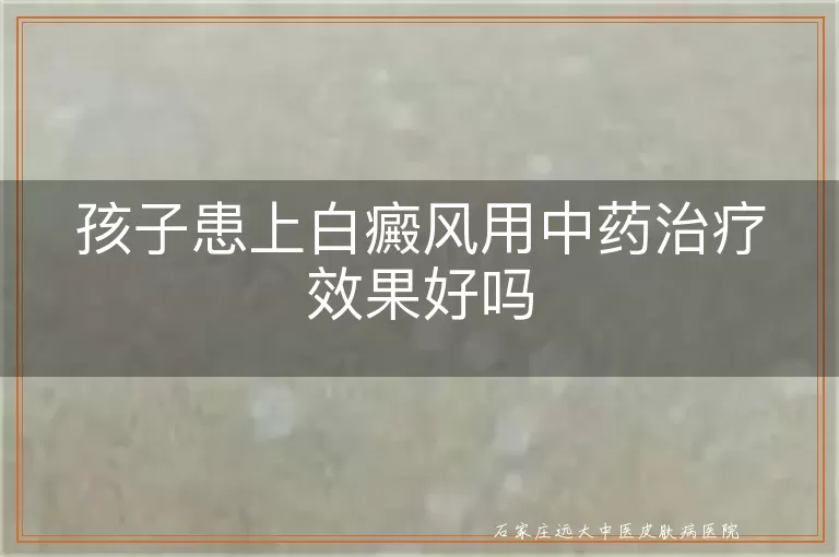 孩子患上白癜风用中药治疗效果好吗