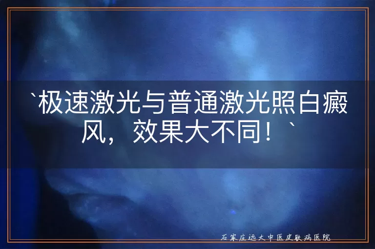 极速激光与普通激光照白癜风，效果大不同！