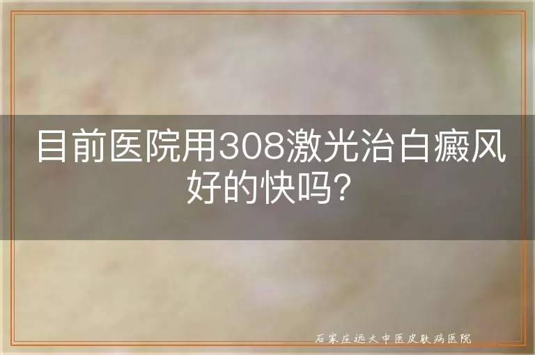 目前医院用308激光治白癜风好的快吗？