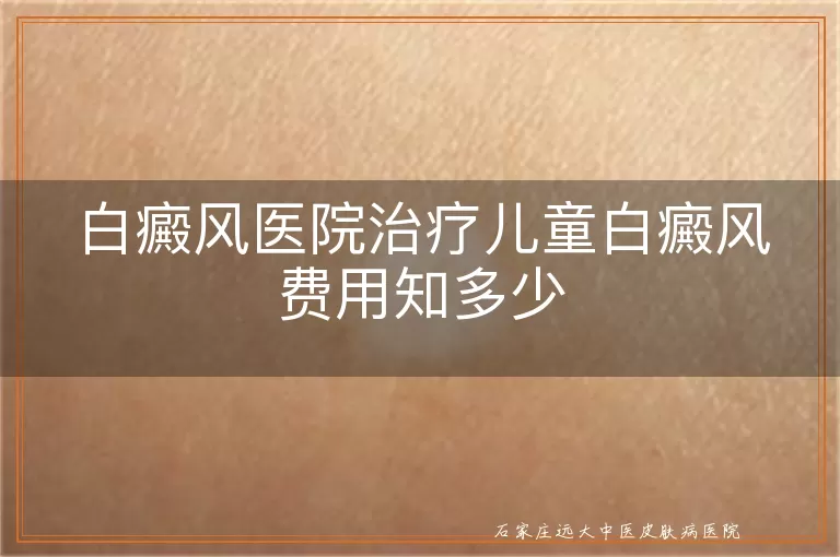 白癜风医院治疗儿童白癜风费用知多少