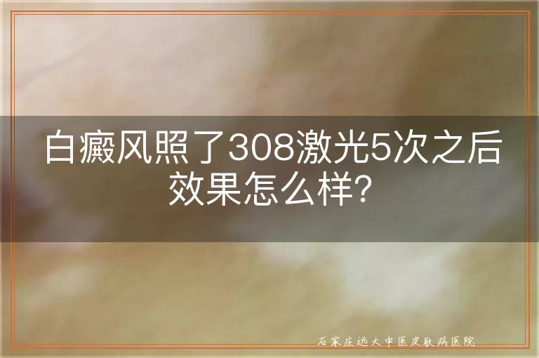 白癜风照了308激光5次之后效果怎么样？