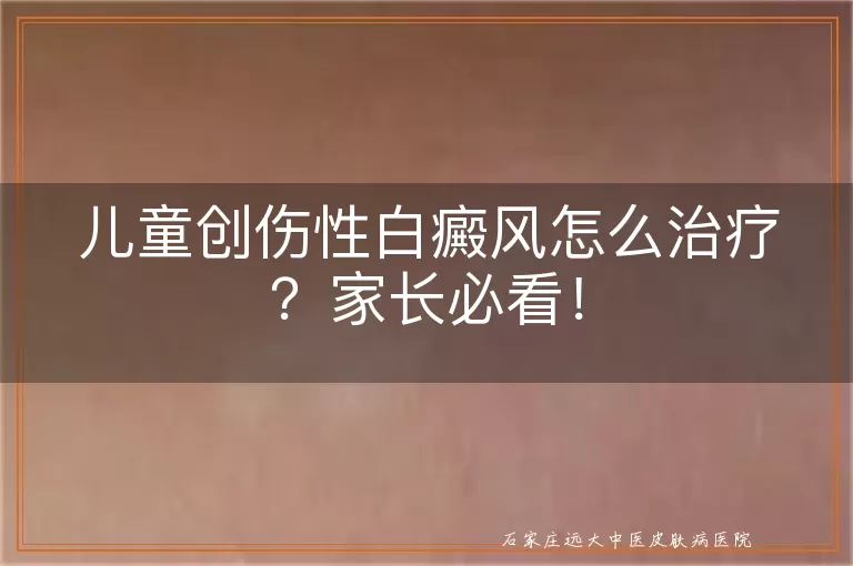 儿童创伤性白癜风怎么治疗？家长必看！