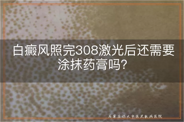 白癜风照完308激光后还需要涂抹药膏吗?