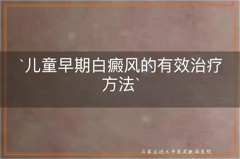 儿童早期白癜风的有效治疗方法