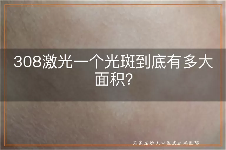 308激光一个光斑到底有多大面积？