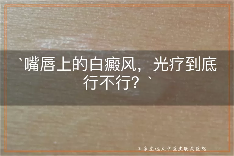嘴唇上的白癜风，光疗到底行不行？
