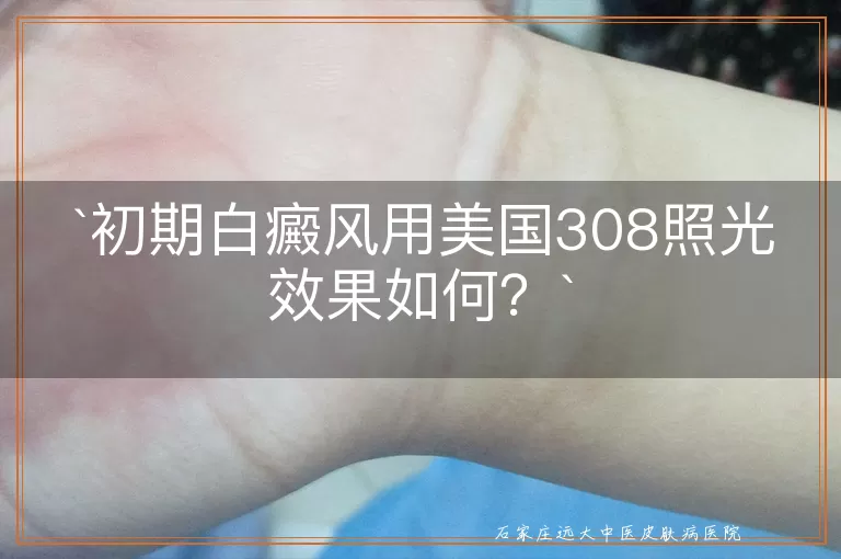 初期白癜风用美国308照光效果如何？