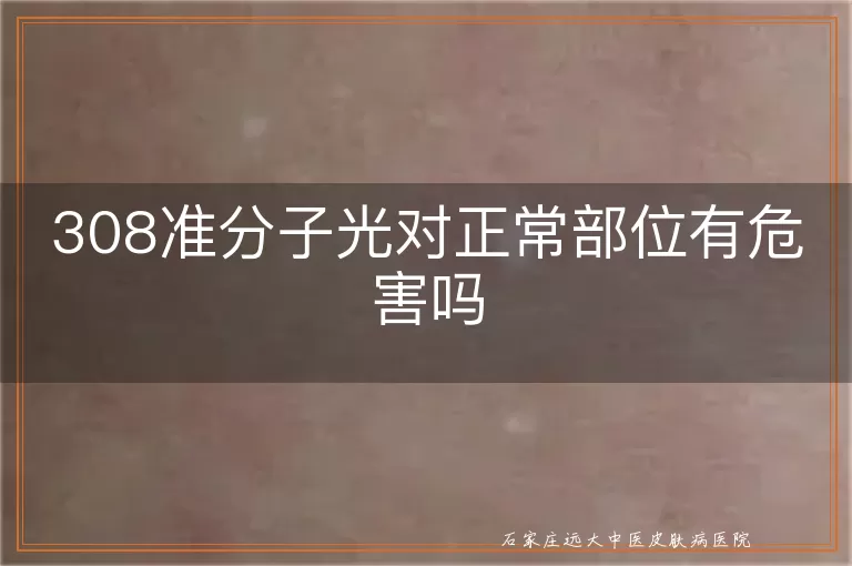 308准分子光对正常部位有危害吗