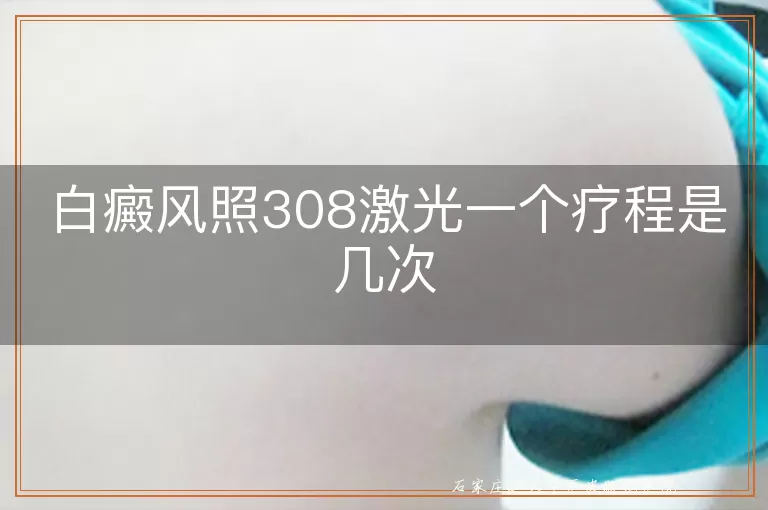 白癜风照308激光一个疗程是几次