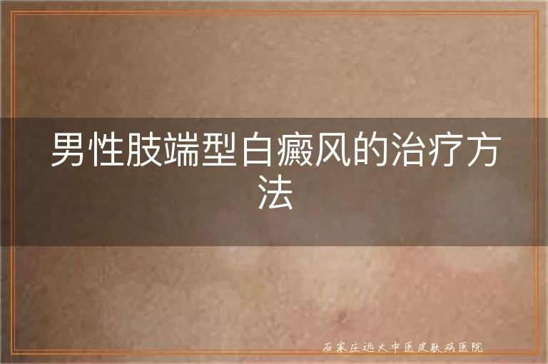 男性肢端型白癜风的治疗方法