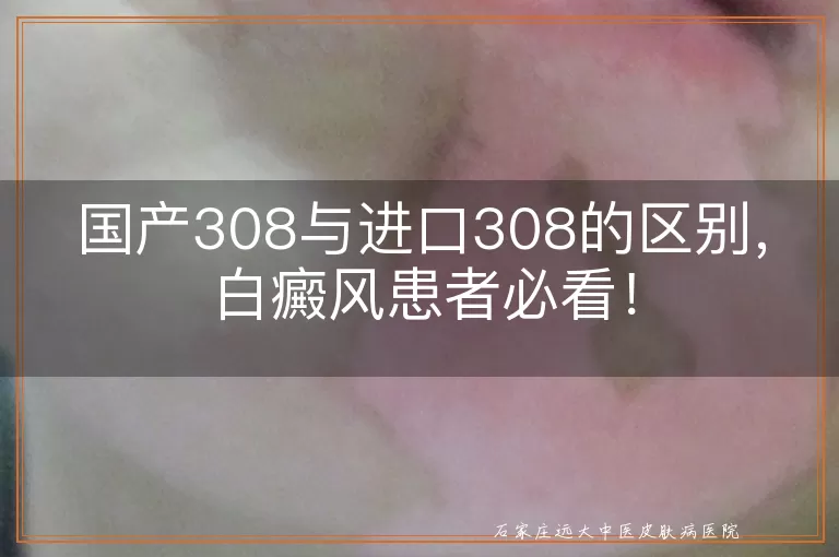 国产308与进口308的区别，白癜风患者必看！