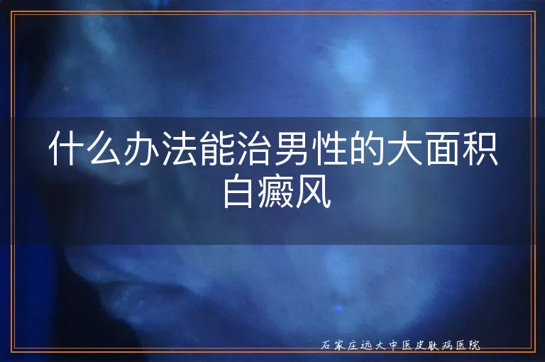 什么办法能治男性的大面积白癜风