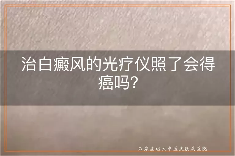 治白癜风的光疗仪照了会得癌吗？