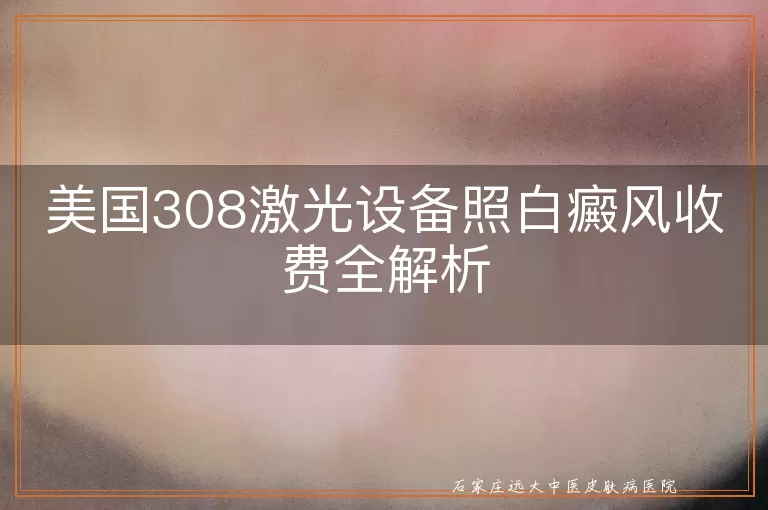 美国308激光设备照白癜风收费全解析