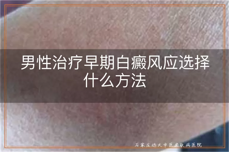 男性治疗早期白癜风应选择什么方法