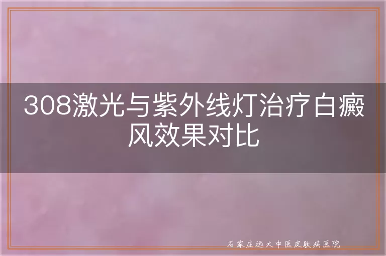 308激光与紫外线灯治疗白癜风效果对比