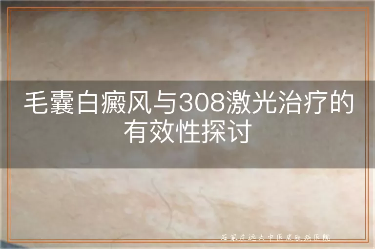 毛囊白癜风与308激光治疗的有效性探讨