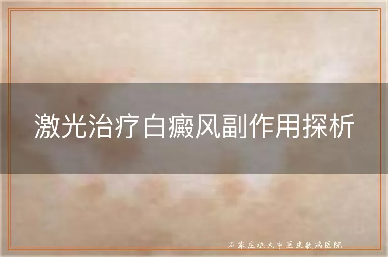 激光治疗白癜风副作用探析