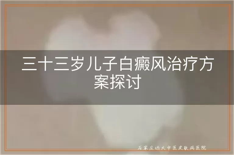 三十三岁儿子白癜风治疗方案探讨