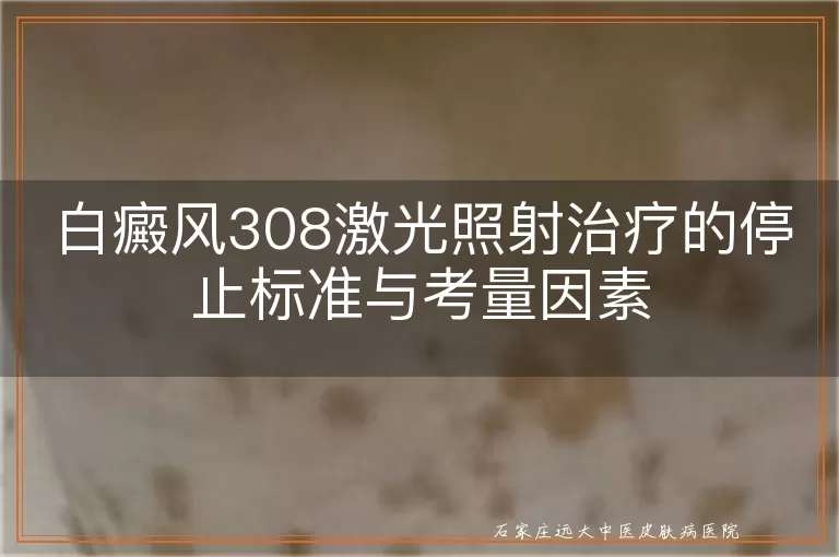 白癜风308激光照射治疗的停止标准与考量因素