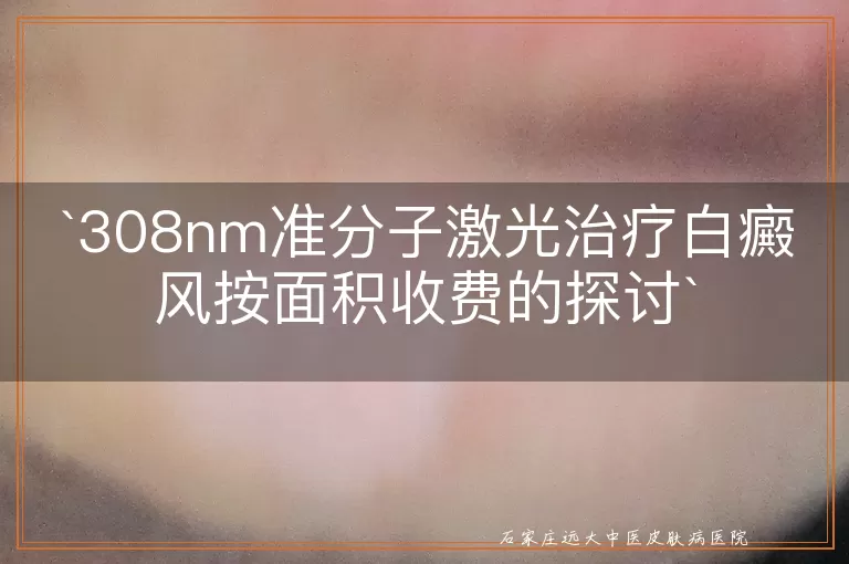 308nm准分子激光治疗白癜风按面积收费的探讨