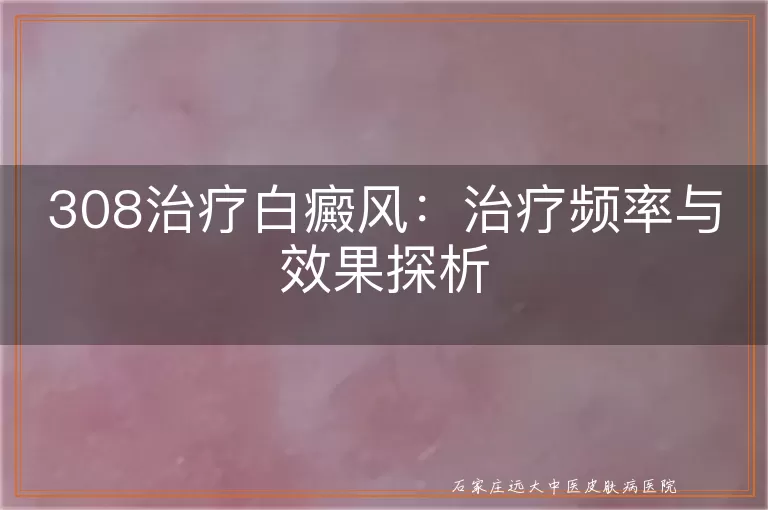 308治疗白癜风：治疗频率与效果探析