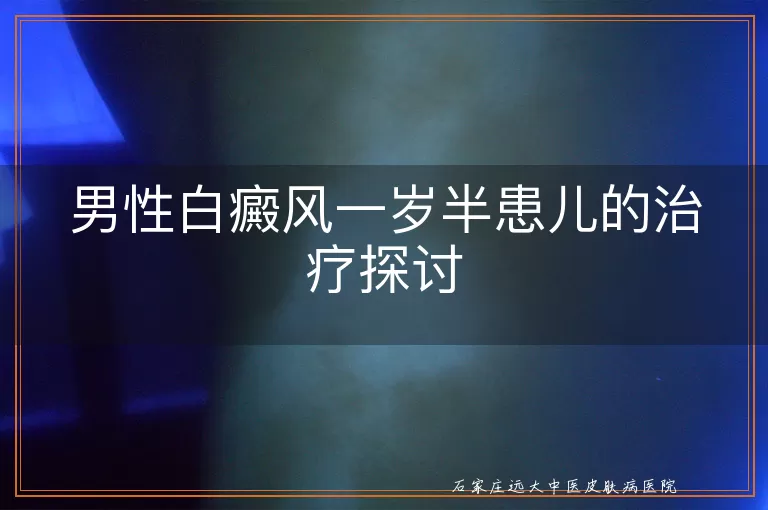 男性白癜风一岁半患儿的治疗探讨