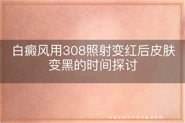 白癜风用308照射变红后皮肤变黑的时间探讨