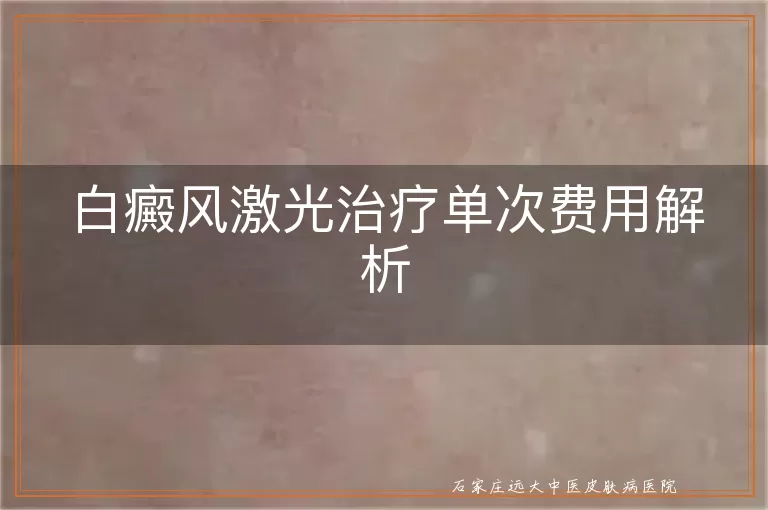 白癜风激光治疗单次费用解析