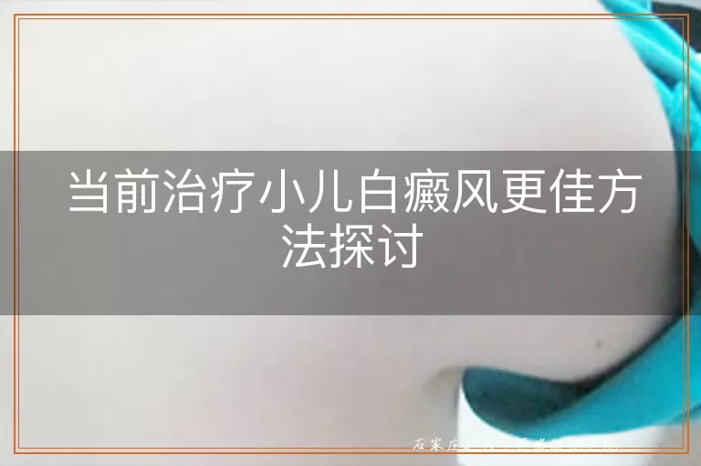 当前治疗小儿白癜风更佳方法探讨