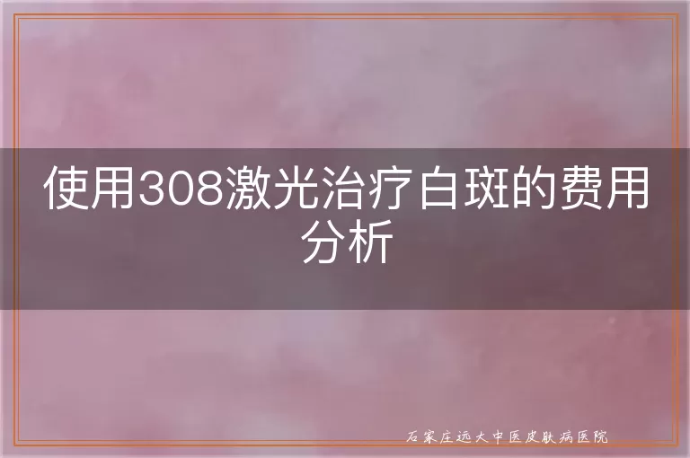 使用308激光治疗白斑的费用分析